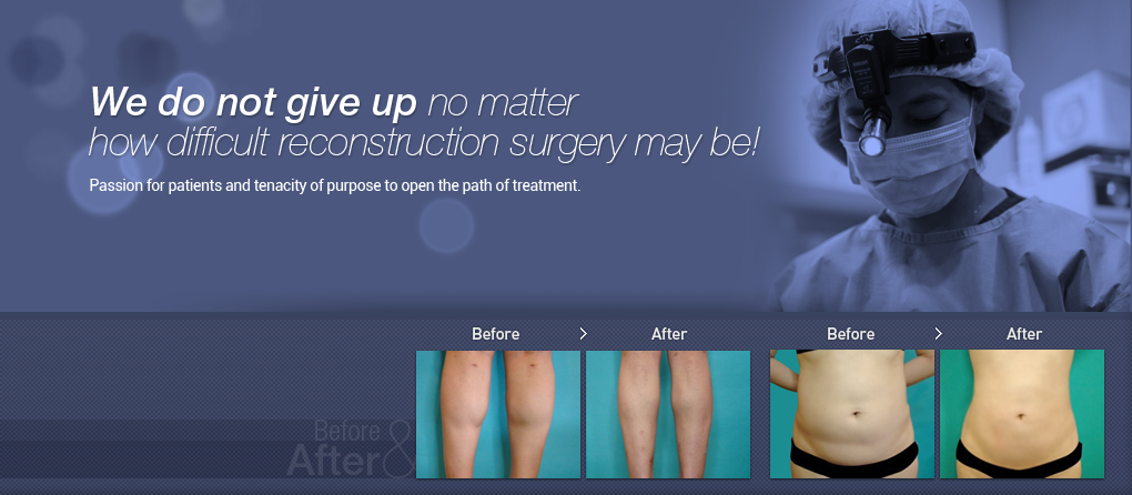 We do not give up no matter how difficult reconstruction surgery may be!!