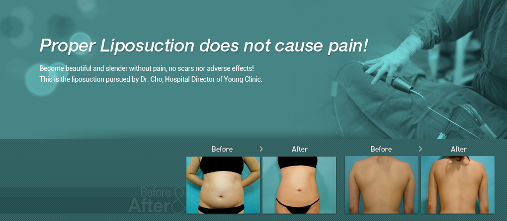 Proper Liposuction does not cause pain!