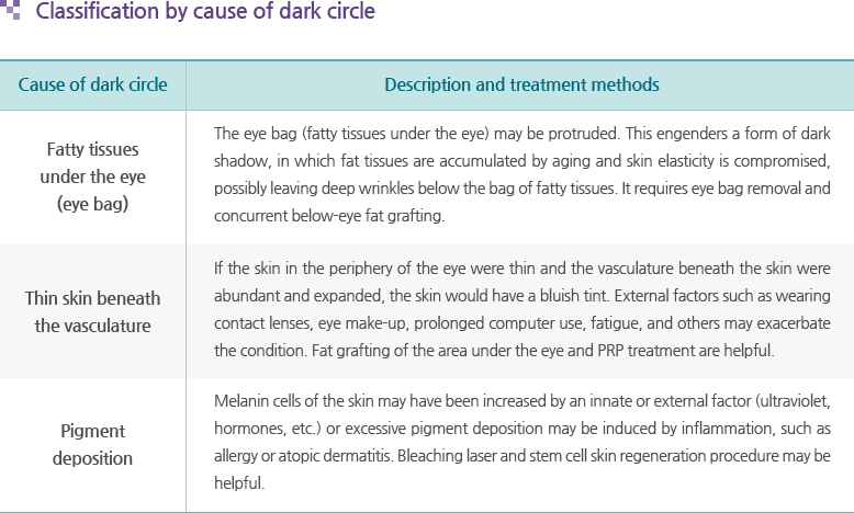 Classification by cause of dark circle